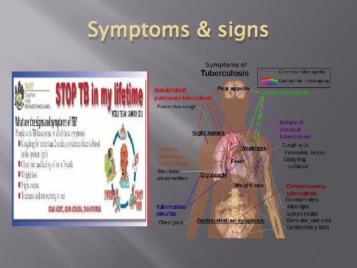 Symptoms & signs 