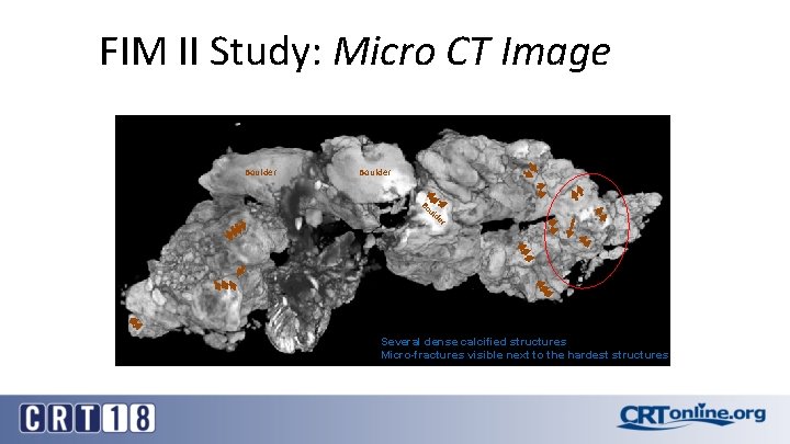 FIM II Study: Micro CT Image Boulder Bo ul d er Several dense calcified