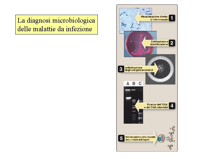 La diagnosi microbiologica delle malattie da infezione 