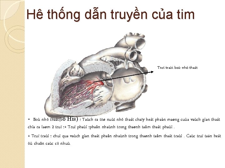 Hê thống dẫn truyền của tim Truï traùi boù nhó thaát - Boù nhó