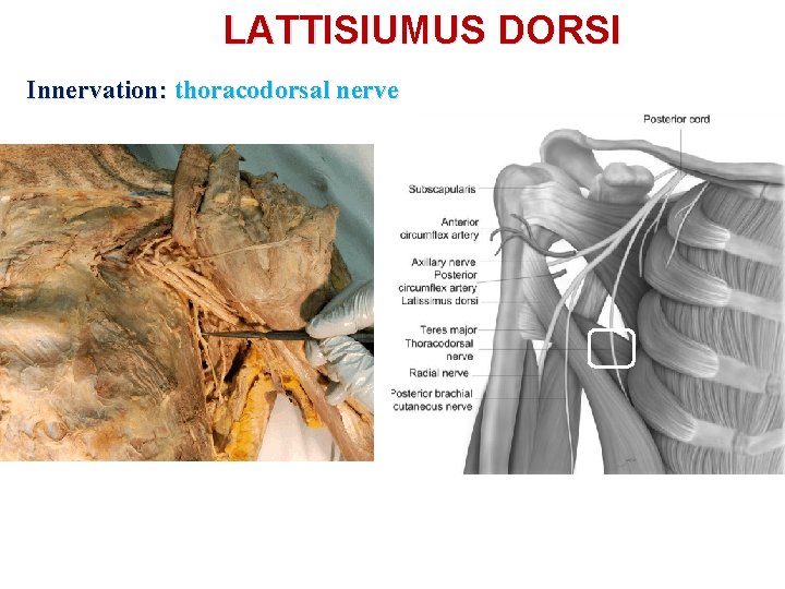 LATTISIUMUS DORSI Innervation: thoracodorsal nerve 