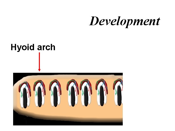Development Hyoid arch 