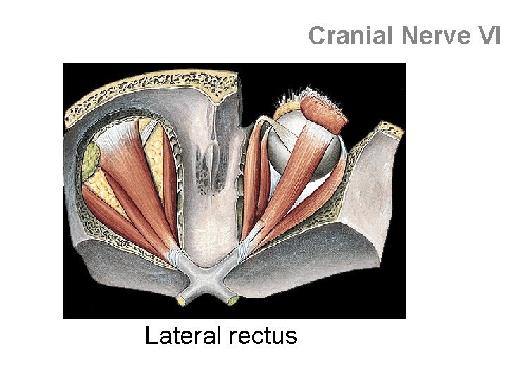 Cranial Nerve VI Lateral rectus 