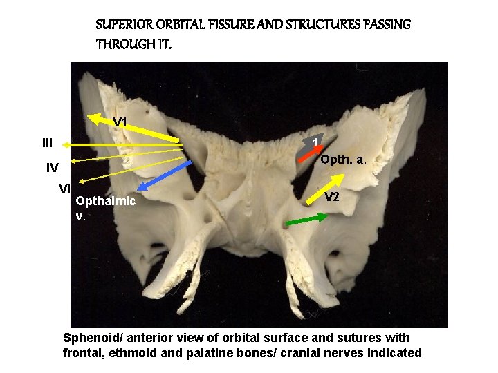 SUPERIOR ORBITAL FISSURE AND STRUCTURES PASSING THROUGH IT. V 1 III 1 Opth. a.