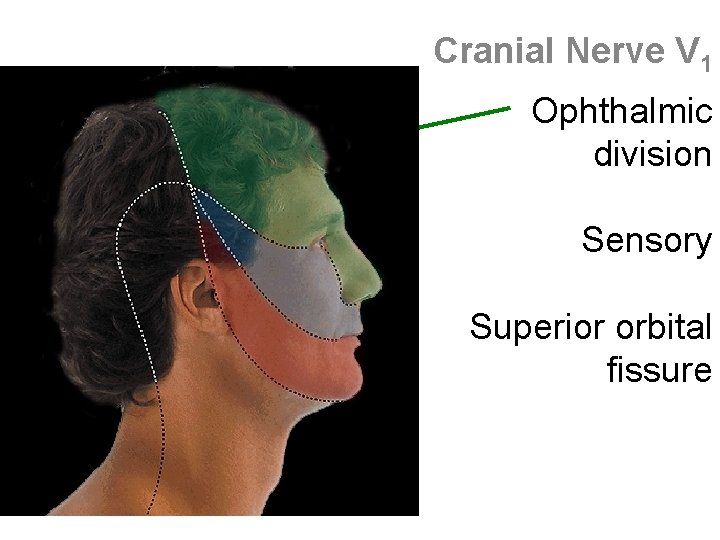 Cranial Nerve V 1 Ophthalmic division Sensory Superior orbital fissure 