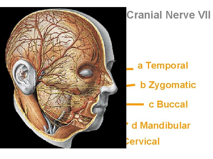 Cranial Nerve VII a Temporal b Zygomatic c Buccal d Mandibular e Cervical 