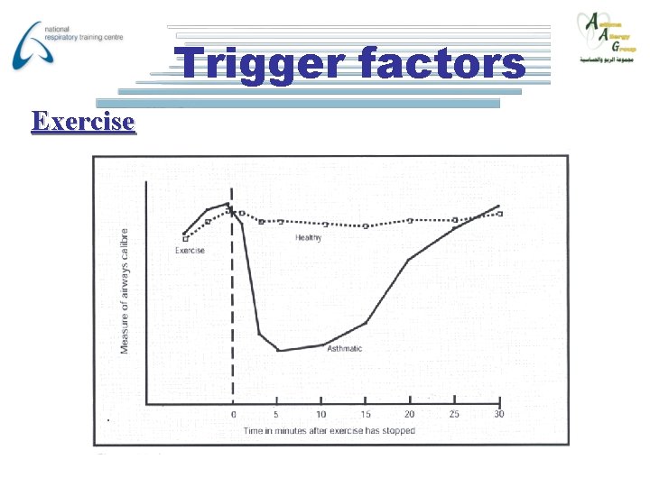 Trigger factors Exercise 