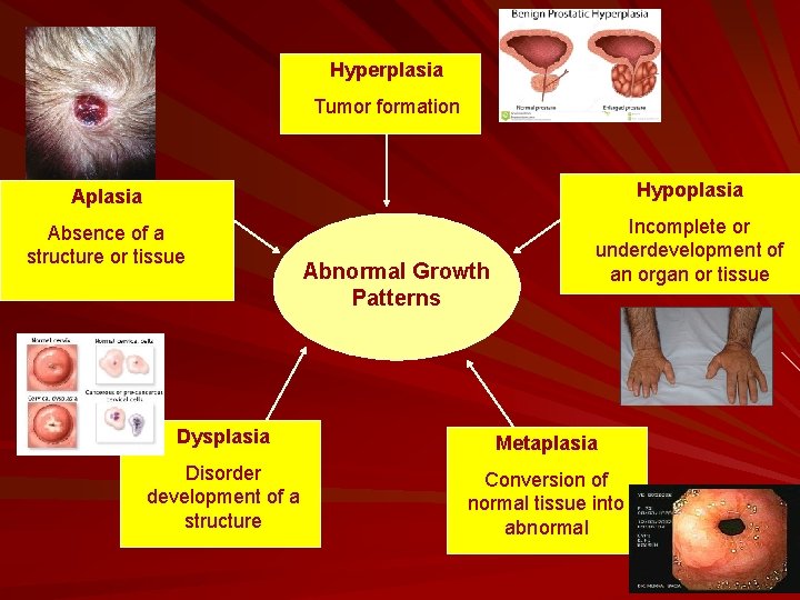 Hyperplasia Tumor formation Aplasia Hypoplasia Absence of a structure or tissue Incomplete or underdevelopment