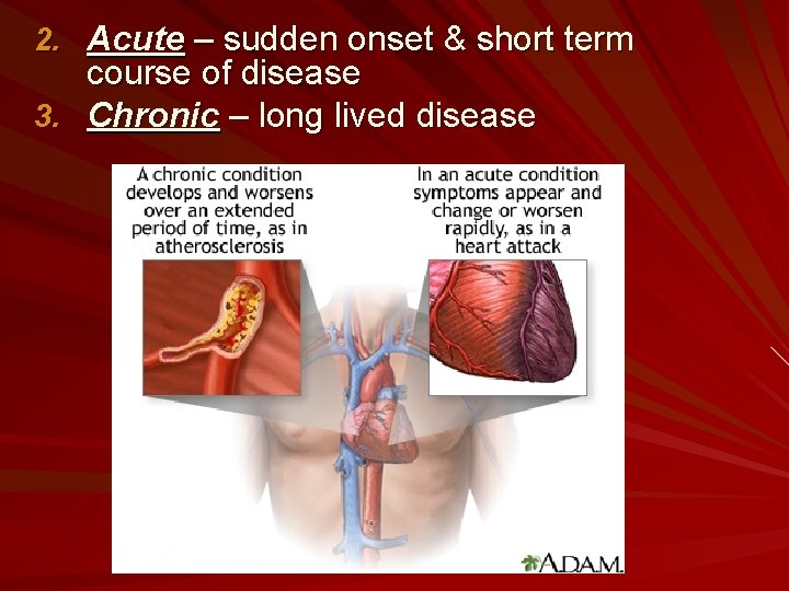 2. Acute – sudden onset & short term course of disease 3. Chronic –