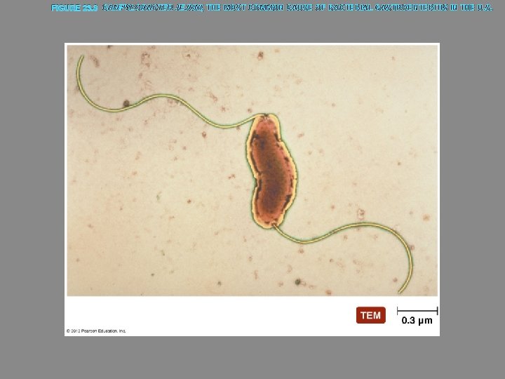 FIGURE 23. 8 CAMPYLOBACTER JEJUNI, THE MOST COMMON CAUSE OF BACTERIAL GASTROENTERITIS IN THE