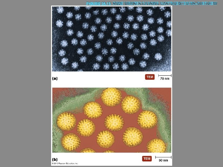 FIGURE 23. 13 SOME VIRUSES CAUSING GASTROENTERITIS-OVERVIEW 