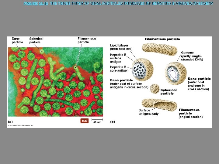 FIGURE 23. 15 THE THREE TYPES OF VIRAL PARTICLES PRODUCED BY HEPATITIS B VIRUSES-OVERVIEW