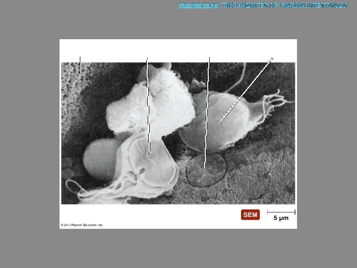 FIGURE 23. 16 TROPHOZOITES OF GIARDIA INTESTINALIS Intestinal villi Ventral adhesive disk Mark left
