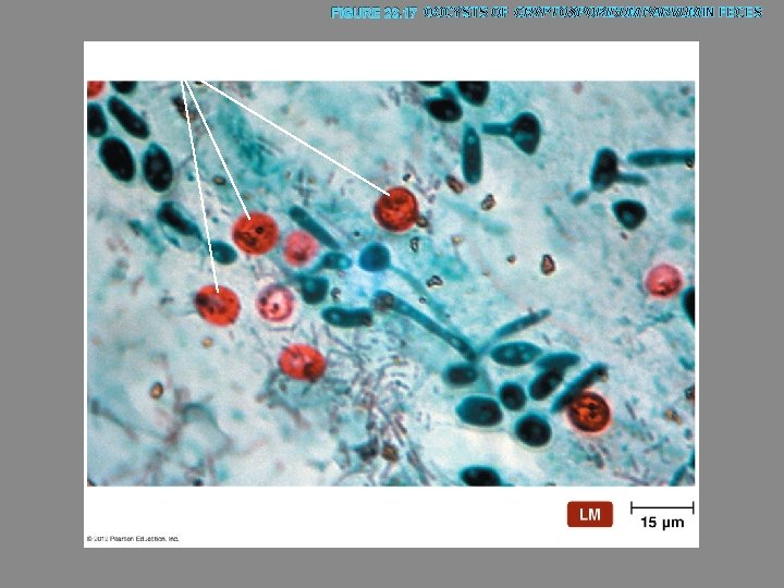 FIGURE 23. 17 OOCYSTS OF CRYPTOSPORIDUM PARVUM IN FECES Oocysts 
