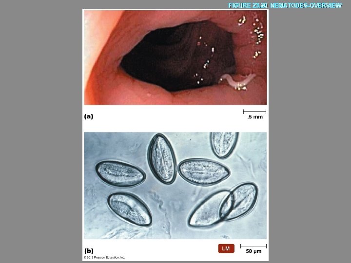 FIGURE 23. 20 NEMATODES-OVERVIEW 