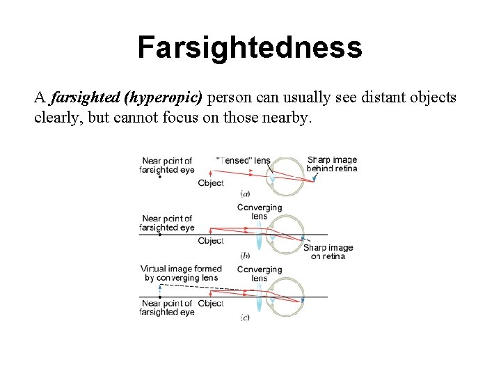 Farsightedness A farsighted (hyperopic) person can usually see distant objects clearly, but cannot focus