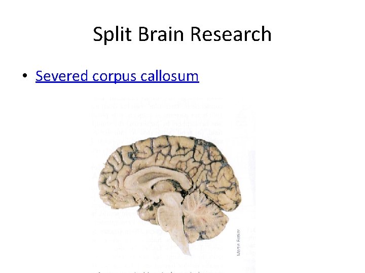 Split Brain Research • Severed corpus callosum Copyright © 2010 by Worth Publishers 
