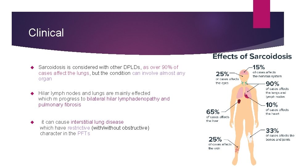 Clinical Sarcoidosis is considered with other DPLDs, as over 90% of cases affect the