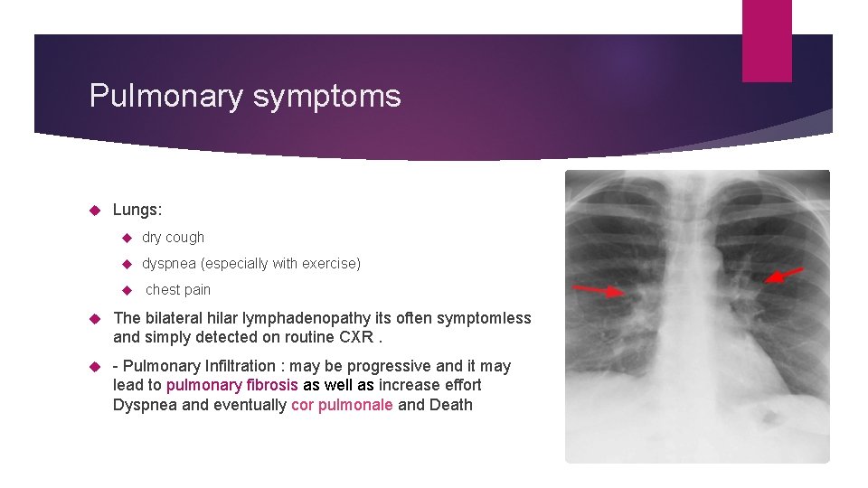 Pulmonary symptoms Lungs: dry cough dyspnea (especially with exercise) chest pain The bilateral hilar