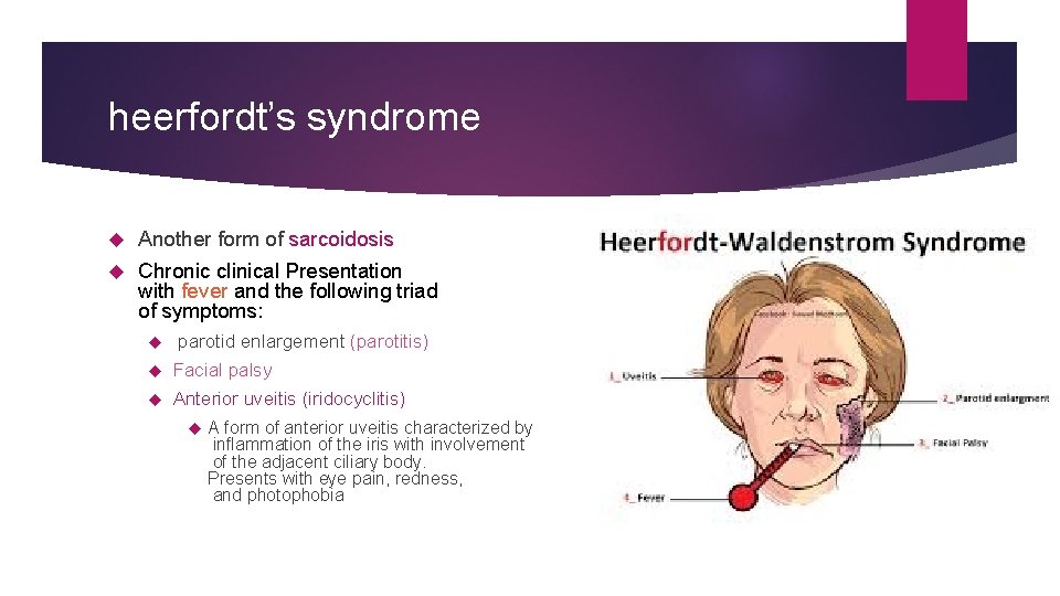 heerfordt’s syndrome Another form of sarcoidosis Chronic clinical Presentation with fever and the following