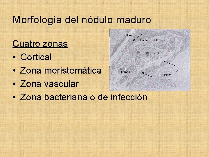 Morfología del nódulo maduro Cuatro zonas • Cortical • Zona meristemática • Zona vascular