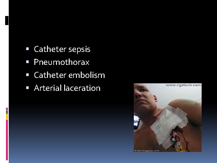  Catheter sepsis Pneumothorax Catheter embolism Arterial laceration 