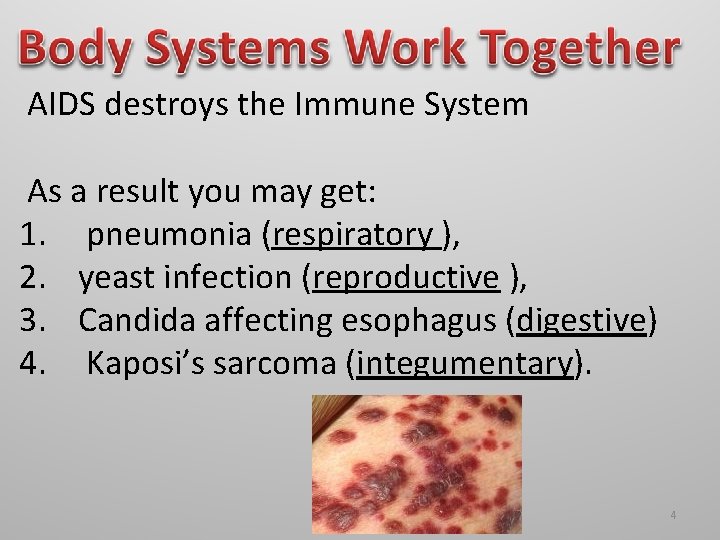 AIDS destroys the Immune System As a result you may get: 1. pneumonia (respiratory AIDS destroys the Immune System As a result you may get: 1. pneumonia (respiratory