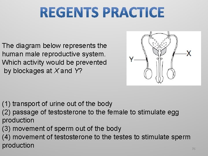 The diagram below represents the human male reproductive system. Which activity would be prevented