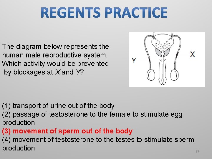 The diagram below represents the human male reproductive system. Which activity would be prevented