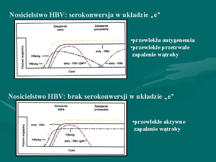 Nosicielstwo HBV: serokonwersja w układzie „e” • przewlekła antygenemia • przewlekłe przetrwałe zapalenie wątroby