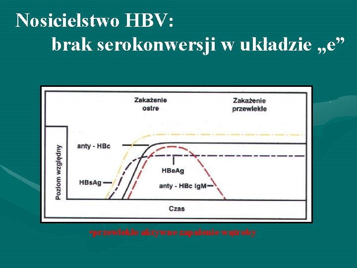 Nosicielstwo HBV: brak serokonwersji w układzie „e” • przewlekłe aktywne zapalenie wątroby 