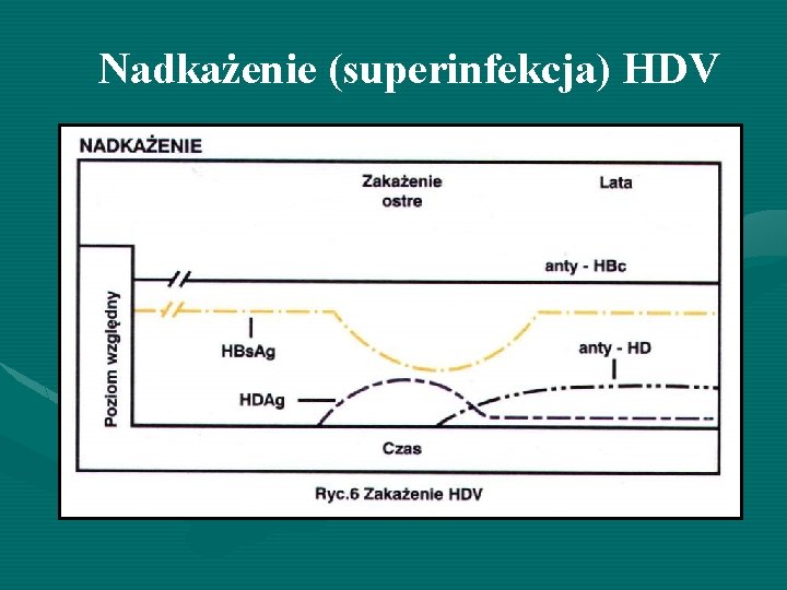 Nadkażenie (superinfekcja) HDV 