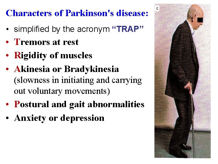 Characters of Parkinson's disease: • simplified by the acronym “TRAP” • Tremors at rest