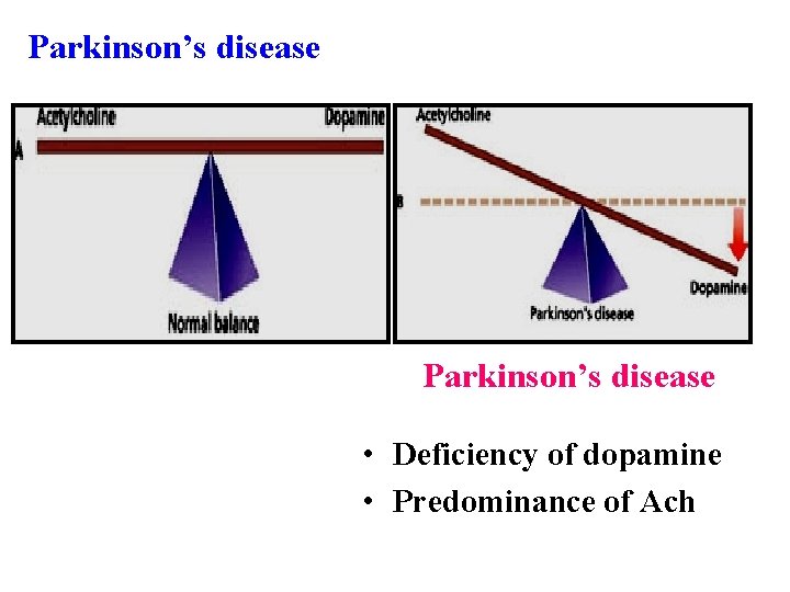 Parkinson’s disease • Deficiency of dopamine • Predominance of Ach 