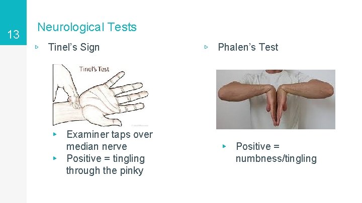 13 Neurological Tests ▹ Tinel’s Sign ▸ Examiner taps over median nerve ▸ Positive