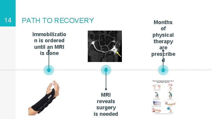 14 PATH TO RECOVERY Immobilizatio n is ordered until an MRI is done MRI