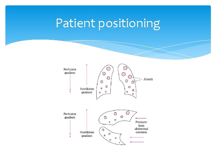 Patient positioning 