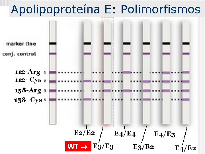 Apolipoproteína E: Polimorfismos WT 
