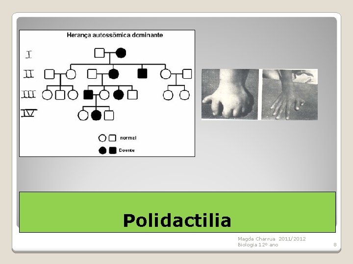 Polidactilia Magda Charrua 2011/2012 Biologia 12º ano 8 