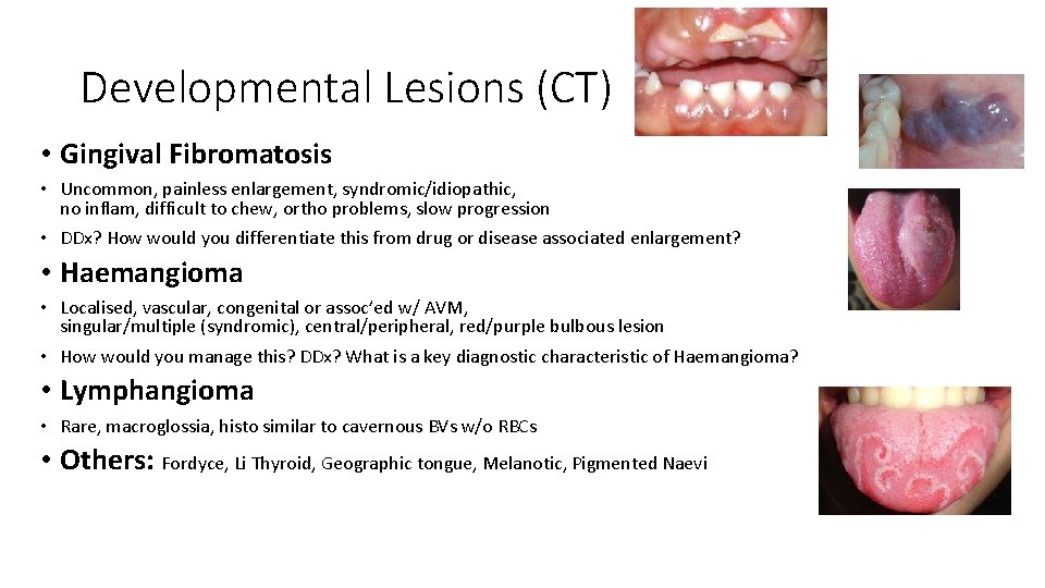 Developmental Lesions (CT) • Gingival Fibromatosis • Uncommon, painless enlargement, syndromic/idiopathic, no inflam, difficult Developmental Lesions (CT) • Gingival Fibromatosis • Uncommon, painless enlargement, syndromic/idiopathic, no inflam, difficult