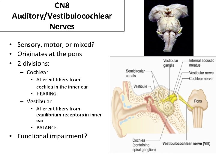 CN 8 Auditory/Vestibulocochlear Nerves • Sensory, motor, or mixed? • Originates at the pons