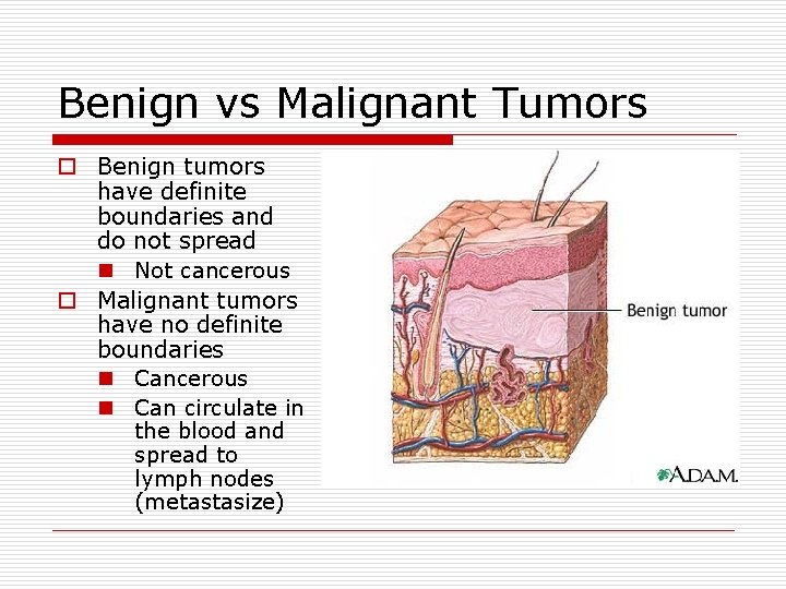 Benign vs Malignant Tumors o Benign tumors have definite boundaries and do not spread