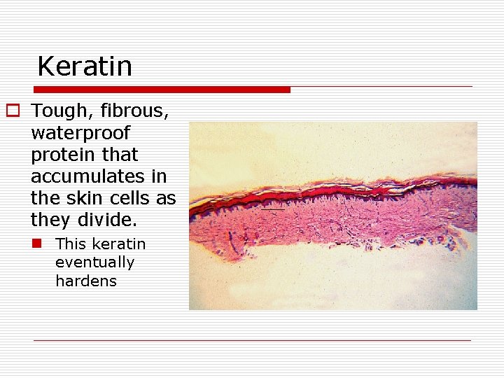 Keratin o Tough, fibrous, waterproof protein that accumulates in the skin cells as they