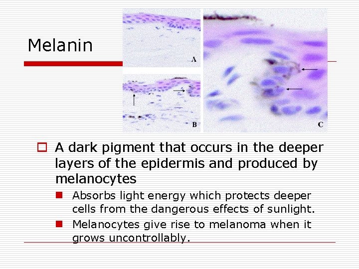 Melanin o A dark pigment that occurs in the deeper layers of the epidermis