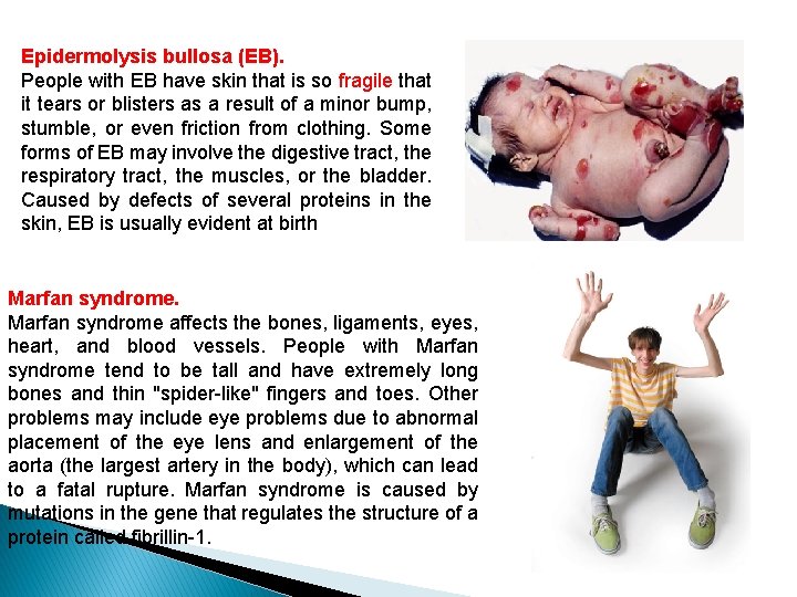 Epidermolysis bullosa (EB). People with EB have skin that is so fragile that it