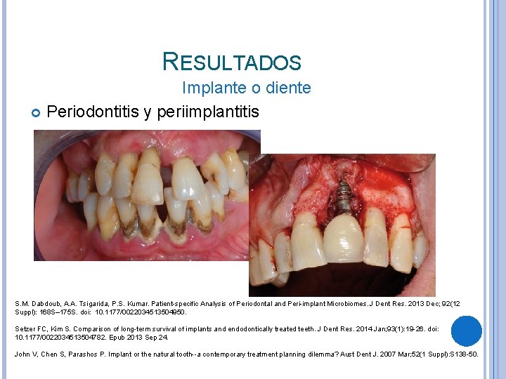 RESULTADOS Implante o diente Periodontitis y periimplantitis S. M. Dabdoub, A. A. Tsigarida, P.