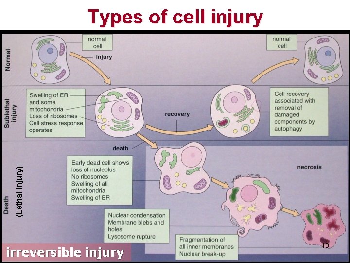 (Lethal injury) Types of cell injury irreversible injury 10 