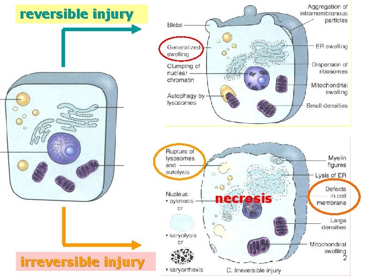 reversible injury necrosis irreversible injury 2 