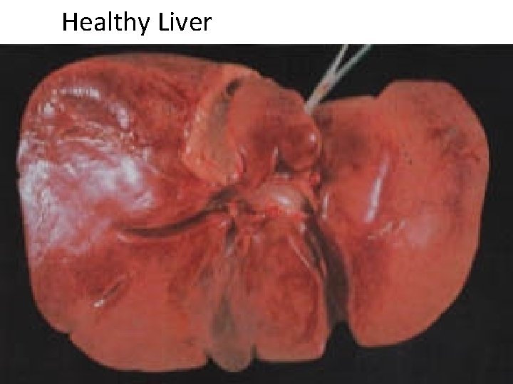 Healthy Liver 