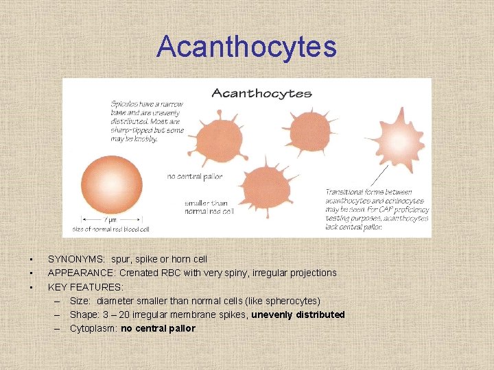 Acanthocytes • • • SYNONYMS: spur, spike or horn cell APPEARANCE: Crenated RBC with